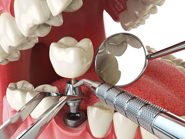 Best Urgent Tooth Repair  in Rio Hondo, TX